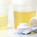 Testiranje na droge: “Zdaj šele hodi ven, kaj vse nekateri konzumirajo”