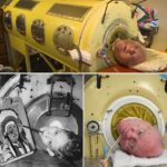 70 let živel v železnih pljučih, nikoli ni razmišljal o evtanaziji