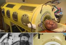 70 let živel v železnih pljučih, nikoli ni razmišljal o evtanaziji