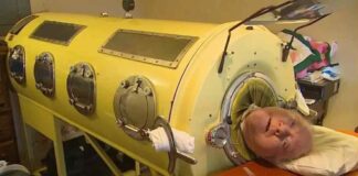 70 let živel v železnih pljučih, nikoli ni razmišljal o evtanaziji